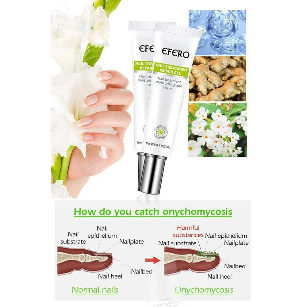 Miniatuur 4